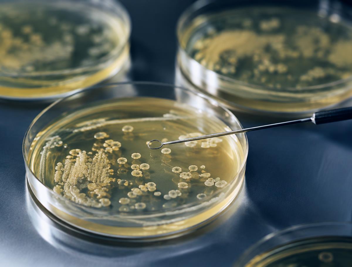 Bacterial colonies on agar plates with an inoculating loop